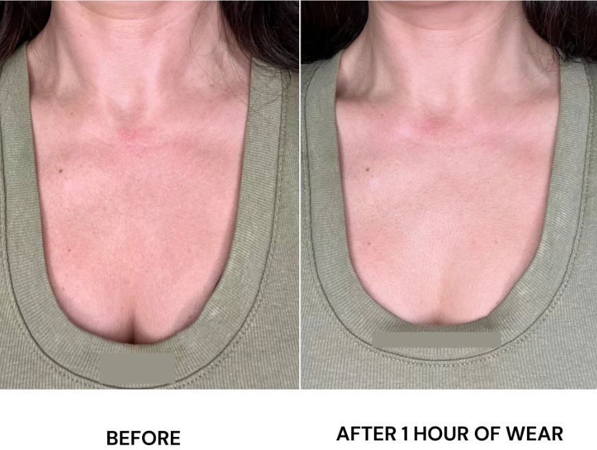 The Secret to Smooth Skin: Silicone Pads for Scars and Wrinkles