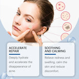 Ouhoe 240pcs Invisible Acne Patches Face Spot Scar Care Pimple Remover Waterproof Acne Healing Concealer Covering Face Stickers