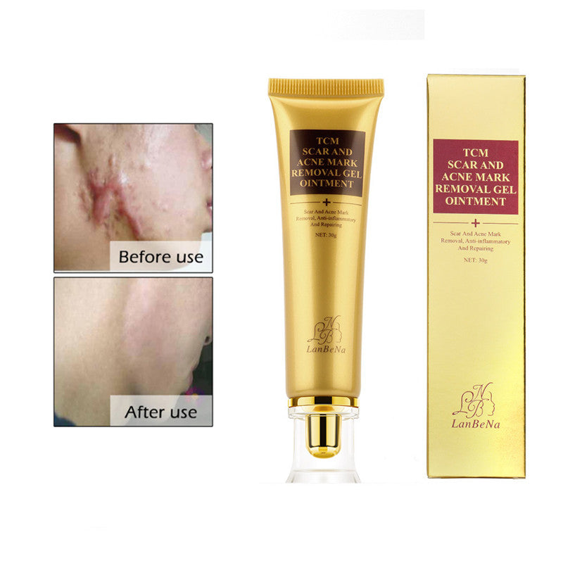 Stretch Mark and Scar Removal Cream