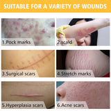 Stretch Mark and Scar Removal Cream
