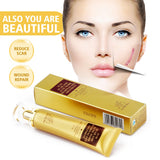 Stretch Mark and Scar Removal Cream