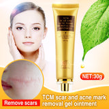 Stretch Mark and Scar Removal Cream