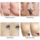 LED Light Facial Mask, 3 Colors